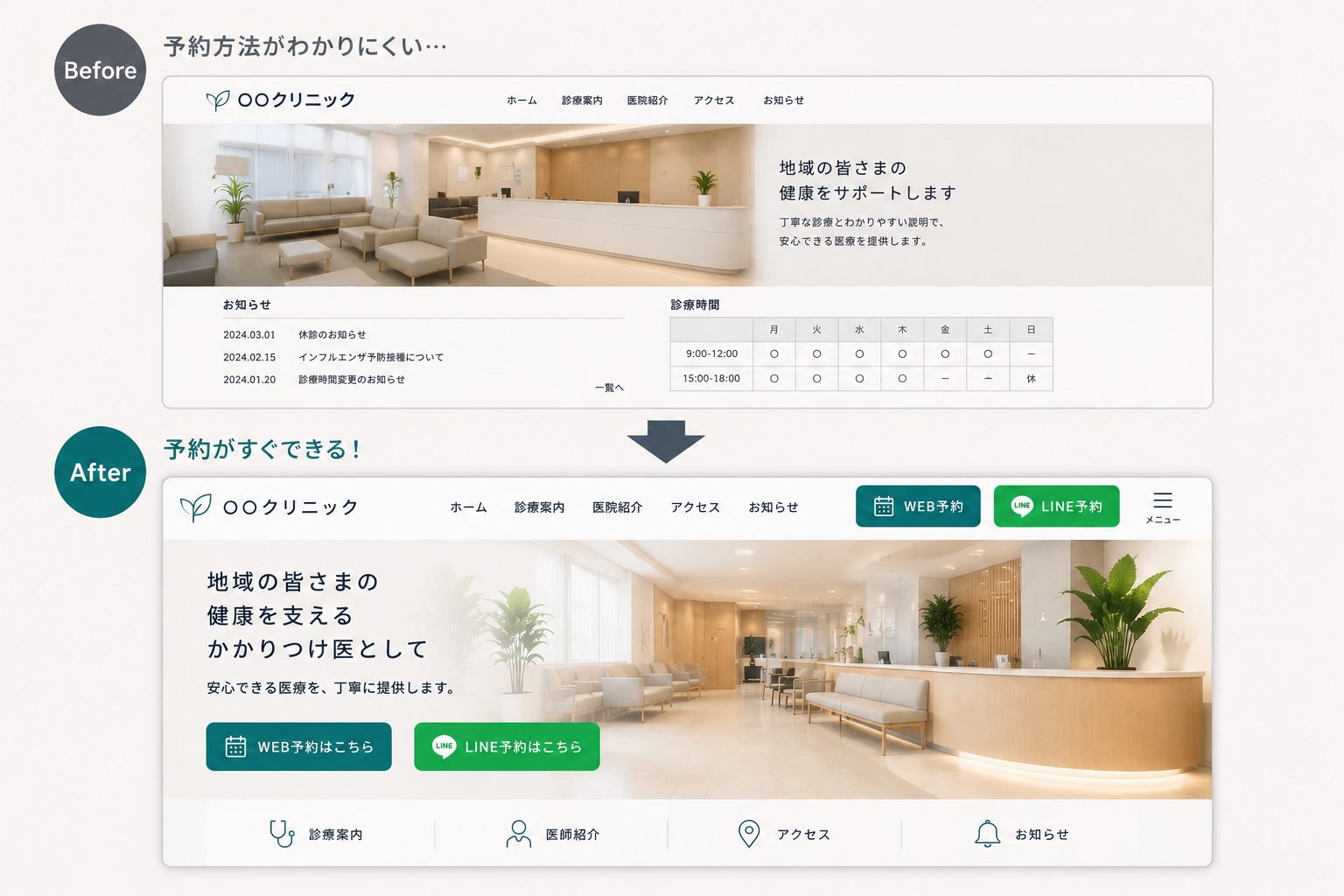 Web予約とLINE予約への導線が改善されたクリニックホームページの比較イメージ